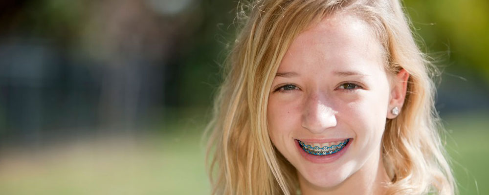 East Palo Alto Orthodontics